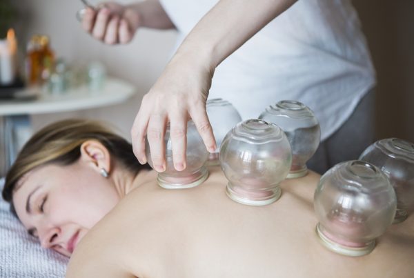 Cupping 800x533